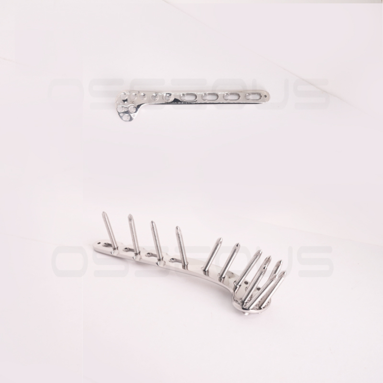 Osseous Surgical – We build Orthopaedic implants & instruments